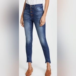 Madewell 10" High-Rise Skinny Jeans: Chewed-Hem Edition Women’s 29 ❤️
